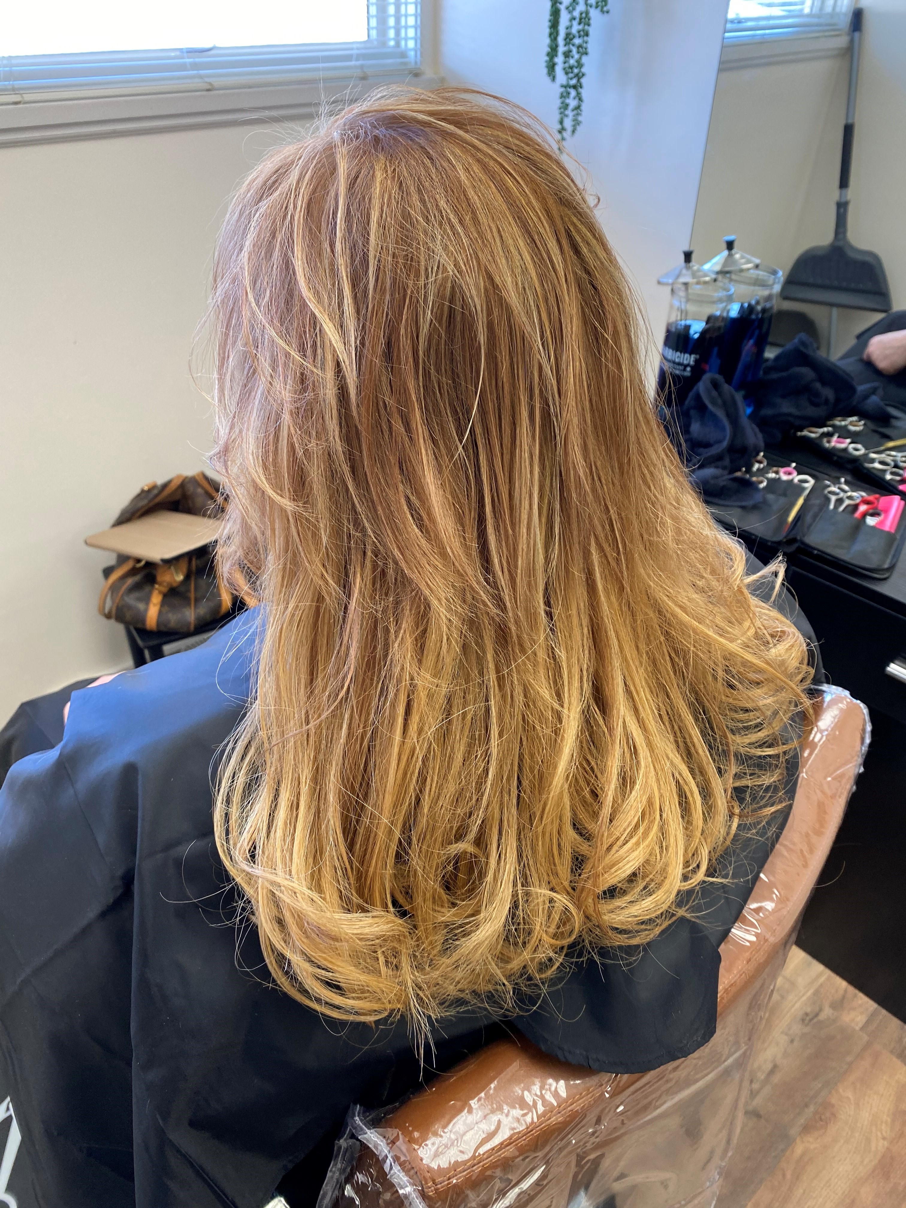 Hair Replacement Transformation