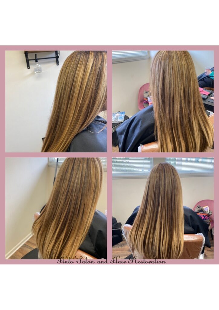 Hair Replacement Transformation