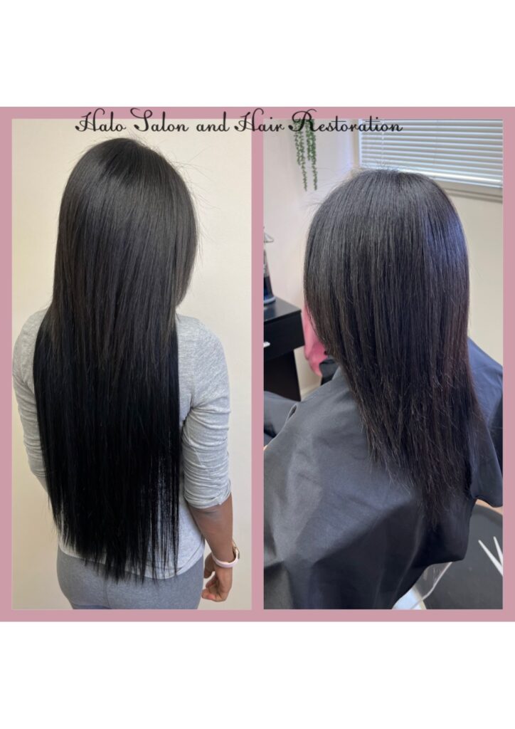 Hair Replacement Transformation